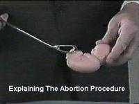  WARNING
You are about to enter an area containing graphic pictures of aborted babies.  
You must be over 12 years of age to proceed.